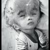 Baby with no name brought from Vinh Long Province to Tu Tu hospital by her mother, Dang Thi Hong Khuyen. She was born in November, 1998 with hydro-encephalitis, and died a month after this photo was taken